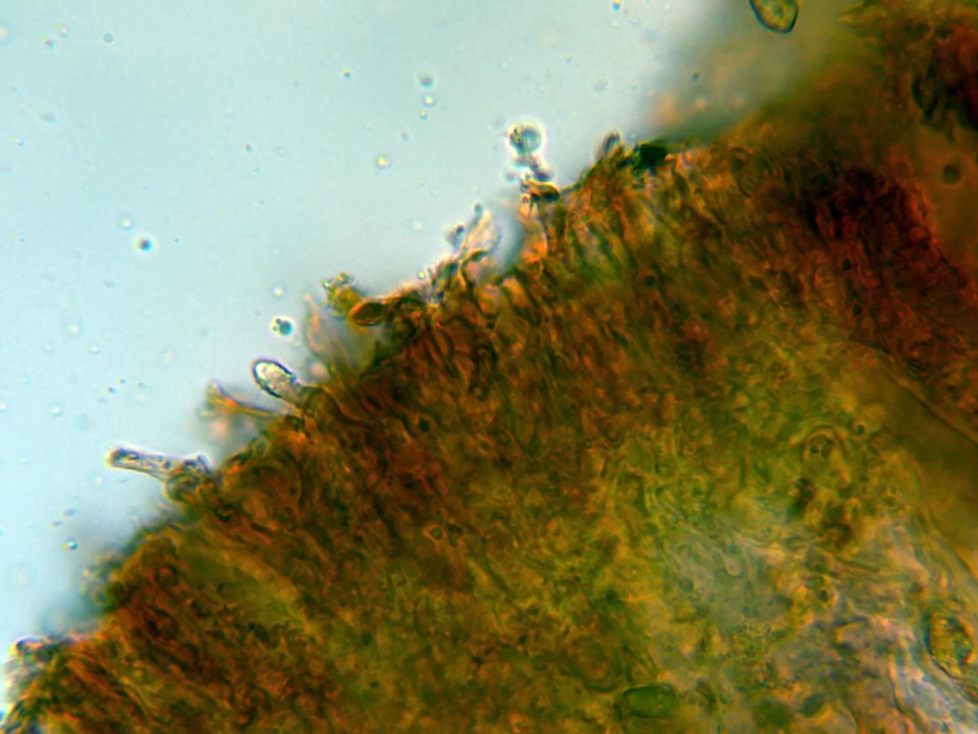 Microscopía de Peniophora rufa - 10 - Himenio-003